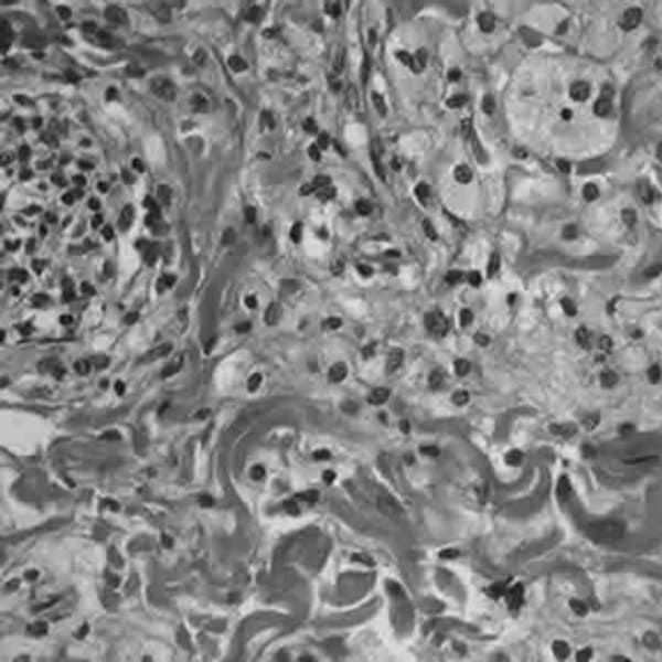 В Ростове-на-Дону зарегистрировали седьмого по счету во всей России ...