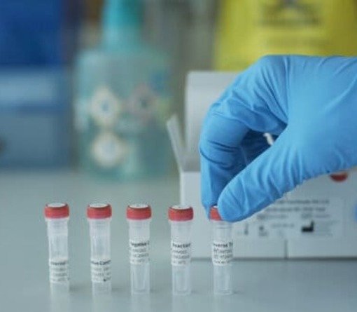 В Ростовской области за сутки выявили 133 зараженных коронавирусом, столько же выписали