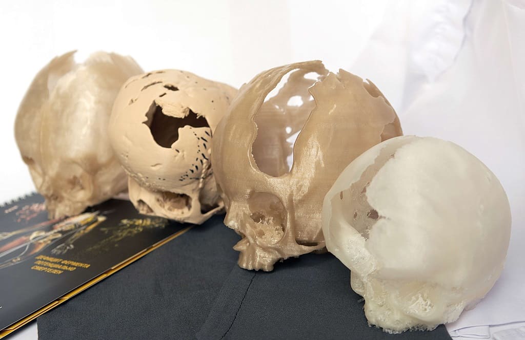 Виртуальное моделирование и создание 3D-макетов черепов с дефектами развития – важнейшие инновации в нейрохирургии. Виртуальное моделирование и создание 3D-макетов черепов с дефектами развития – важнейшие инновации в нейрохирургии.