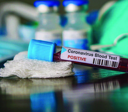 На Дону выявлено еще 167 заболевших коронавирусной инфекцией