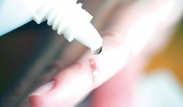 Шить или не шить?