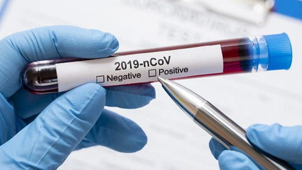 В Ростовской области за сутки выявили еще 92 случая коронавируса