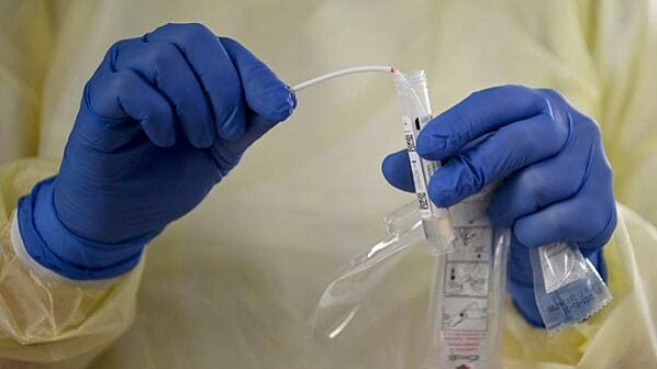 За прошедшие сутки на Дону зарегистрировано 389 заразившихся коронавирусом и 479 выздоровевших жителей