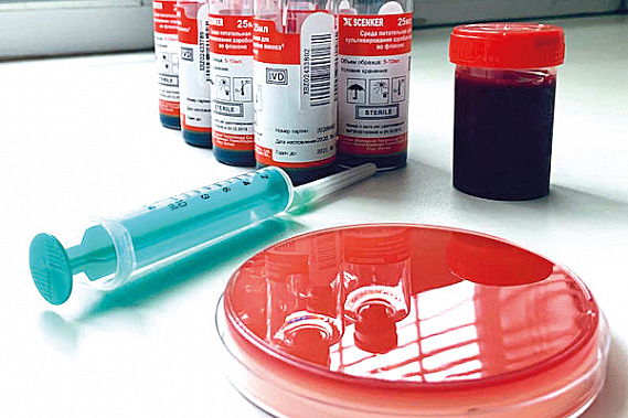 Тест-система для быстрой диагностики сепсиса