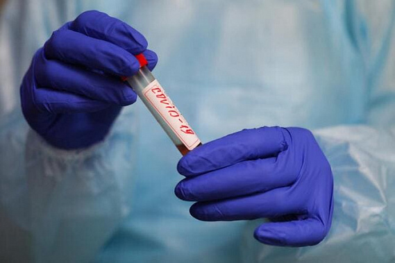 В Ростовской области заболели COVID-19 еще 180 человек