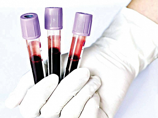 После COVID-19 нужен общий анализ крови