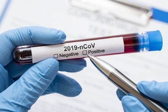 На Дону обнаружено еще 238 заболевших коронавирусной инфекцией
