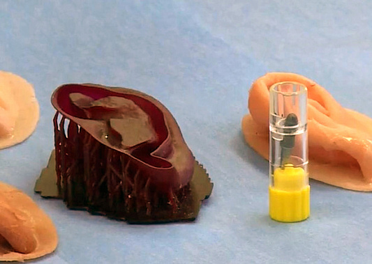 В России сделали искусственное ухо