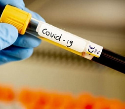 В Ростовской области за сутки зарегистрировано 128 случаев коронавирусной инфекции