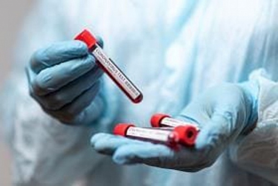 На Дону выявили еще 310 инфицированных коронавирусом