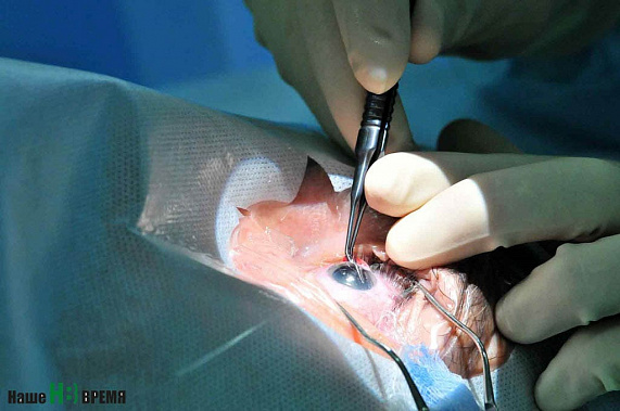 В Ростовской областной клинической больнице начали пересаживать роговицу глаза