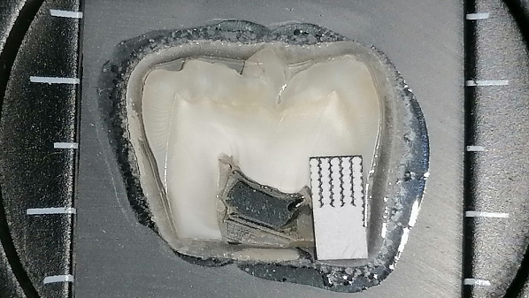 Настоящая защита от кариеса