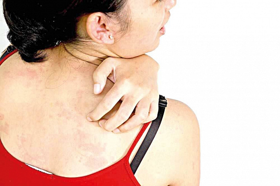 Кожные заболевания вызывает... стресс