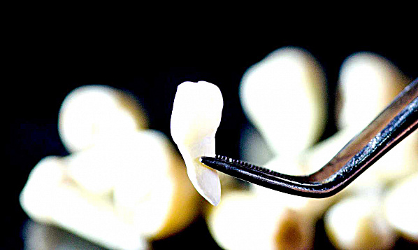 Новые зубы можно будет вырастить