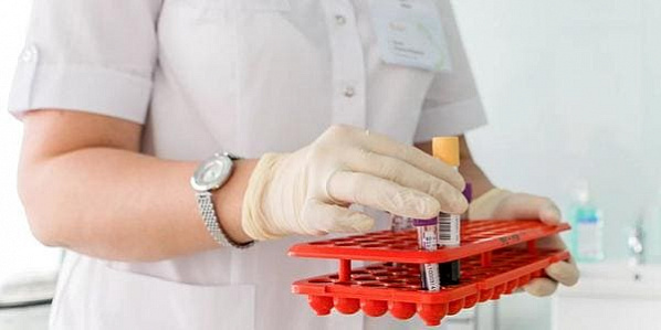 В Ростовской области за сутки зарегистрировано 129  случаев коронавирусной инфекции