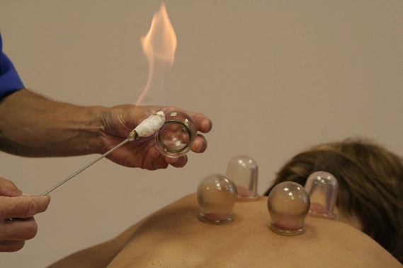 Не всем можно поставить банки