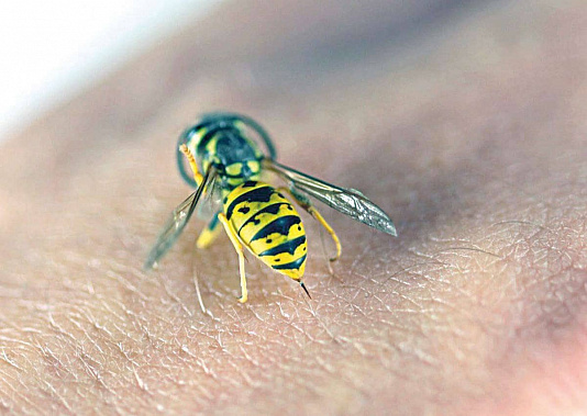 Самые опасные – укусы пчел