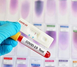 На Дону за сутки выявили еще 127 случаев COVID-19