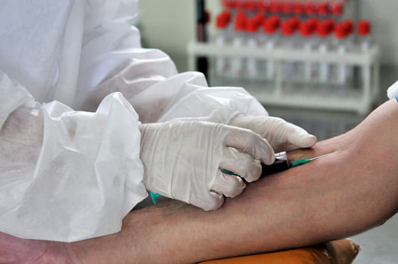 В Ростовской области с 25 мая начинают тестировать на антитела за 900 рублей