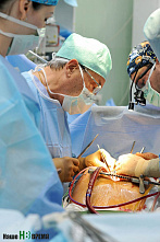 Ишемическая болезнь сердца: что это такое и как с ней бороться