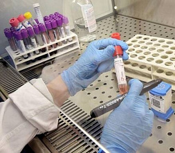 За сутки в Ростовской области выявили еще 122 зараженных коронавирусом