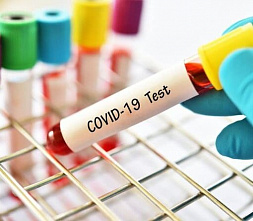 В Ростовской области за сутки выявили еще 93 случая COVID-19