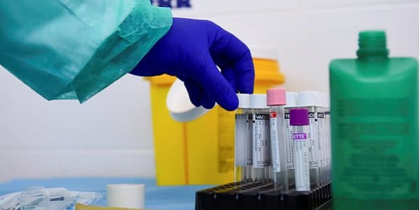 В Ростовской области выявили еще 94 больных коронавирусом