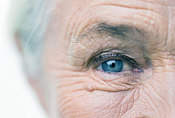 Большие дозы витаминов – причина катаракты