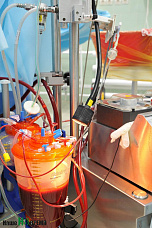 Трансплантология набирает обороты