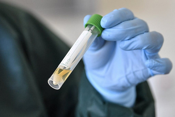 В Ростовской области увеличится число лабораторий, где делают платные тесты на коронавирус