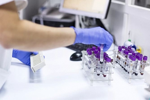 В Ростовской области за сутки выявили 258 новых случаев COVID-19