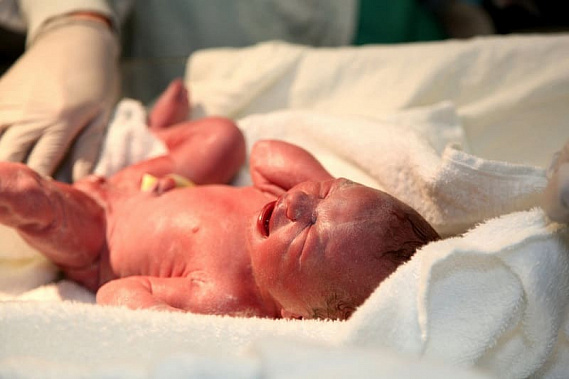 Медицинские критерии рождения уточнили