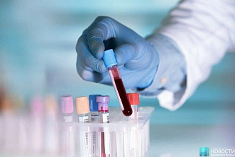 В Ростовской области за сутки зарегистрировано 345 зараженных коронавирусом и 398 выздоровевших