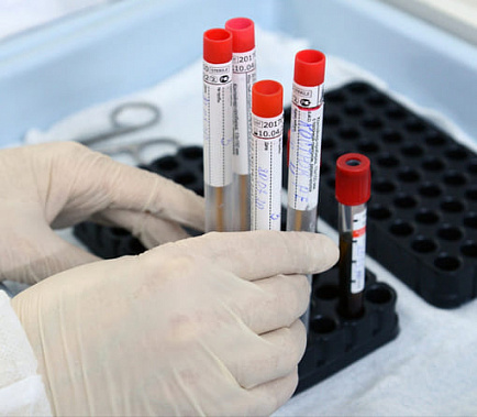 В Ростове за сутки выявили 129 из 165 новых случаев COVID-19 на Дону