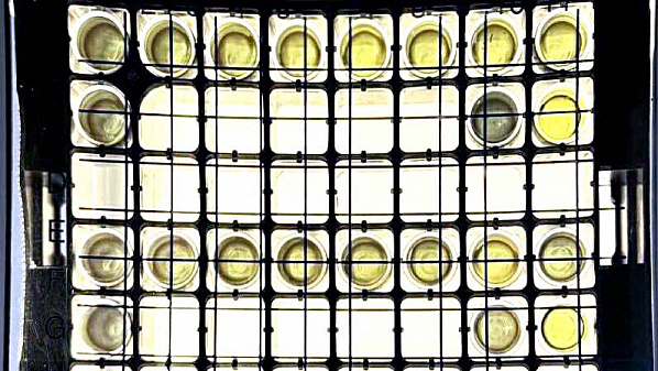 Экспресс-тест для опасных инфекций создали в России