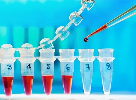 Количество заражений COVID-19 в Ростовской области увеличилось на 92 человека