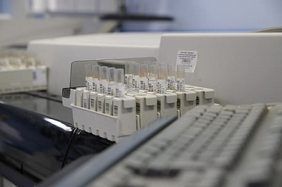 За сутки на Дону коронавирусной инфекцией заболели менее сотни человек