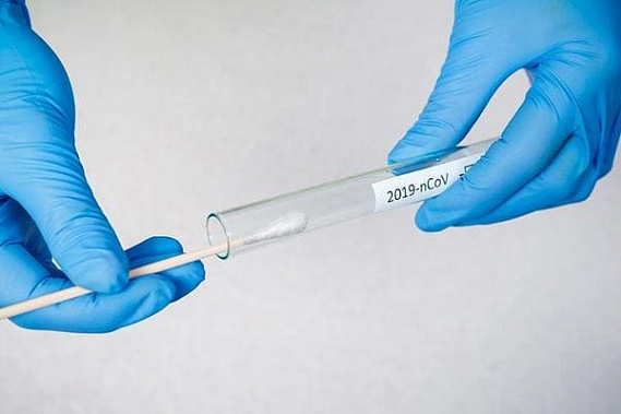 Дадут ли компенсацию на ПЦР-тесты?