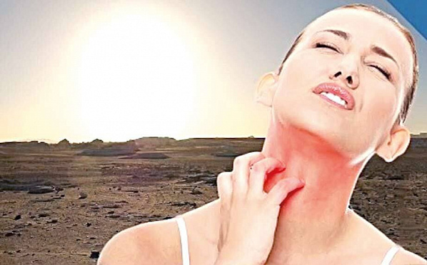 Аллергия на солнце, которой не существует