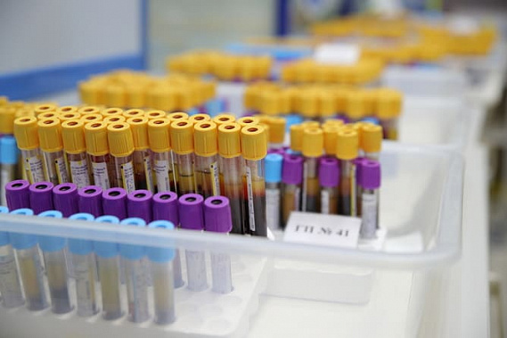 В Ростовской области за сутки выявили еще 308 случаев коронавируса