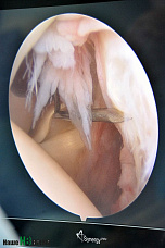 Закрытых зон теперь нет