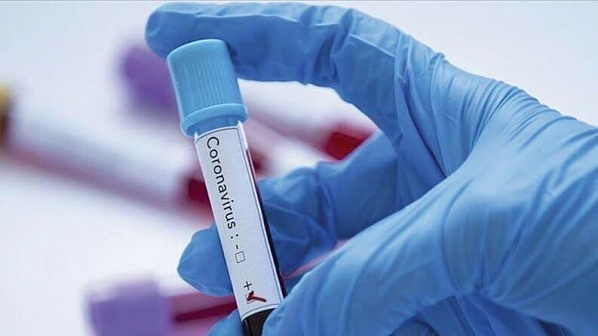 На Дону за сутки выявили 342 зараженных коронавирусом