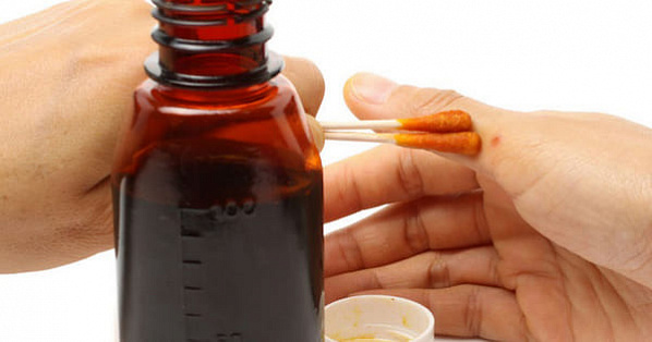 Спиртовой раствор йода поменяйте на водный