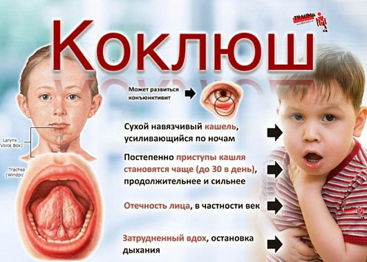 На Дону заболеваемость коклюшем выросла в минувшем году в 20 раз