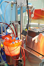 Кардиохирург Александр Дюжиков – о времени и о случае