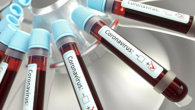 На Дону за вчерашний день зарегистрирован 301 новый случай COVID-19