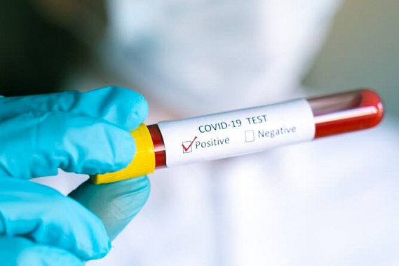 В Ростовской области сейчас болеют COVID-19 более 5 тысяч человек