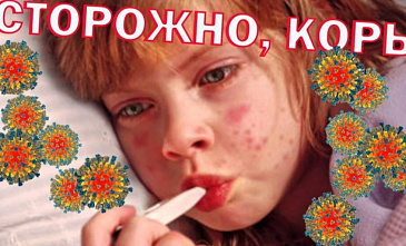 Единственным эффективным способом защиты от кори является вакцинация