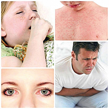 Проявления аллергии могут быть нетипичными