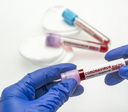 За сутки в Москве выявили более 9 тысяч заболевших COVID-19, на Дону — 156 человек